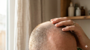 Cuir chevelu qui gratte : signification spirituelle et solutions holistiques